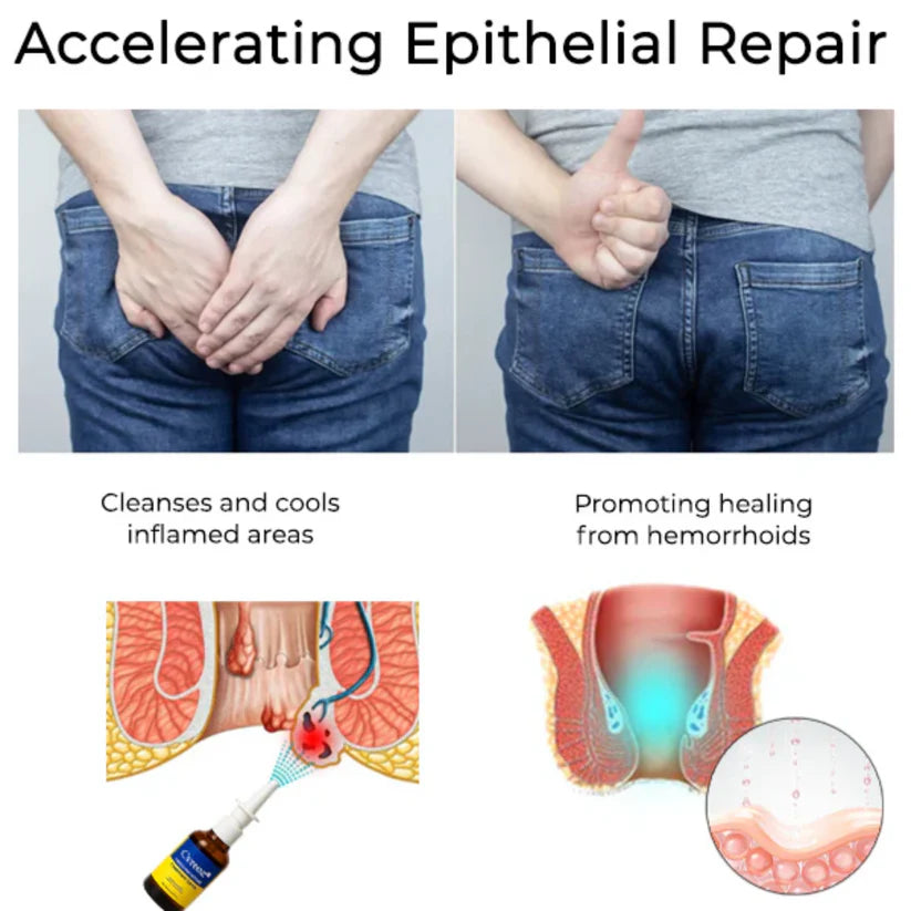 Cvreoz® Herbal Hemorrhoid Treatment Anal Spray (Buy 1 Get 1 Free)