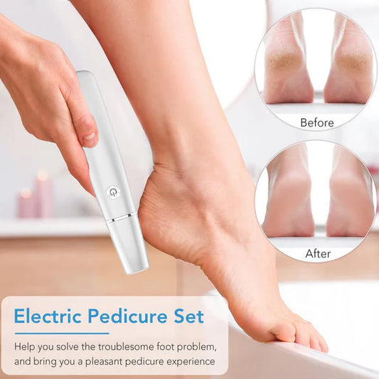 🔥Electric callus remover for feet