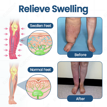 KUBOZN® Official Store|❄️ Ice-Cool Multi-Ball Roller Serum for Lymphatic Support & Swelling Relief (Buy 1 Get 1 Free 🔥🔥)