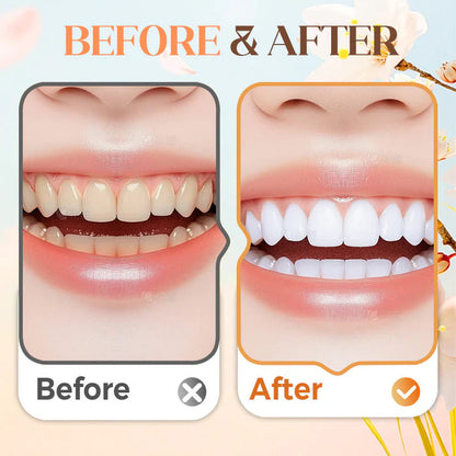 🔥Christmas Limited-Time Offer: 40% OFF!!!🔥120g Fresh Breath & Whitening Toothpaste